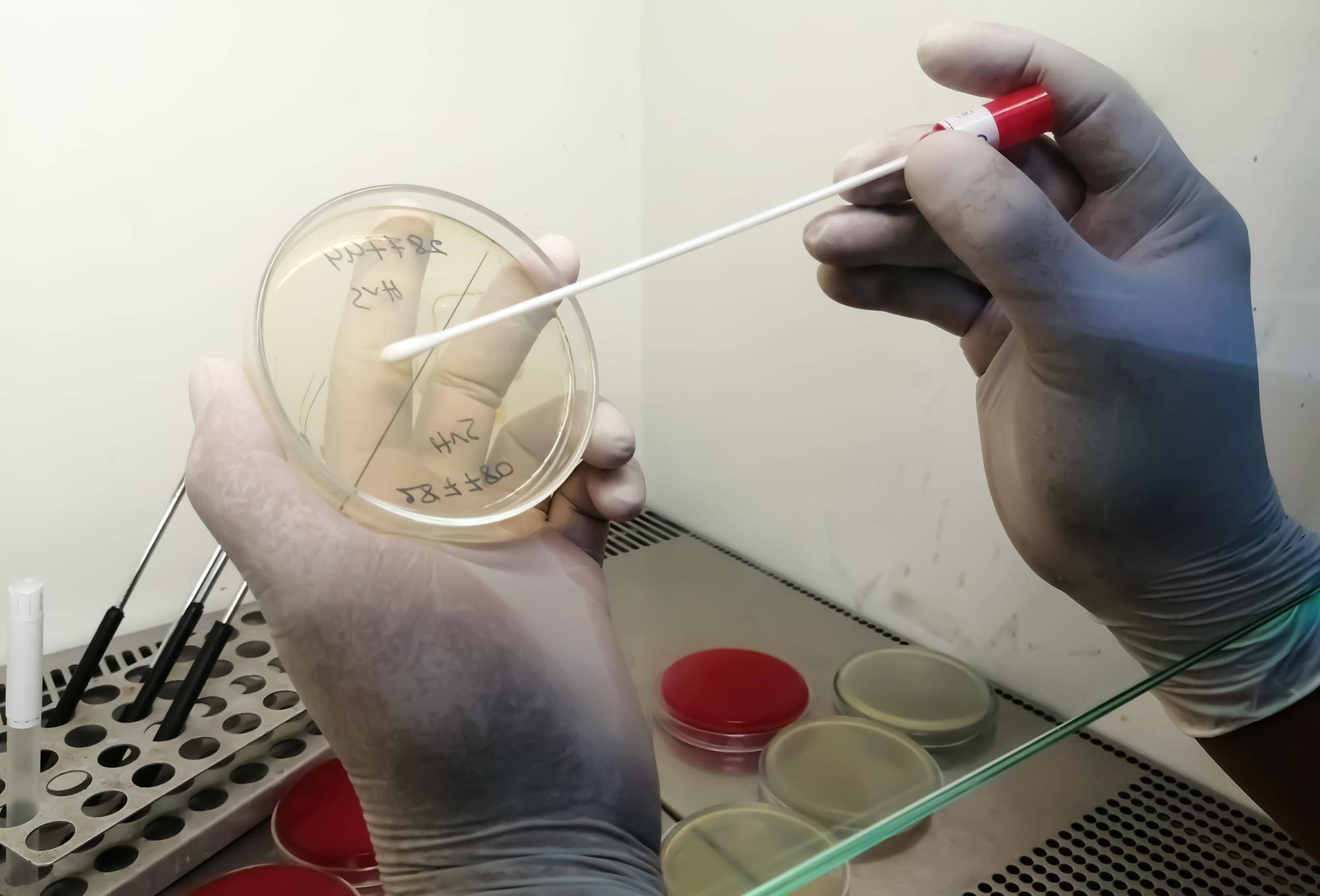 In vitro przygotowanie przebieg szanse ryzyka a decyzja o leczeniu niepłodności